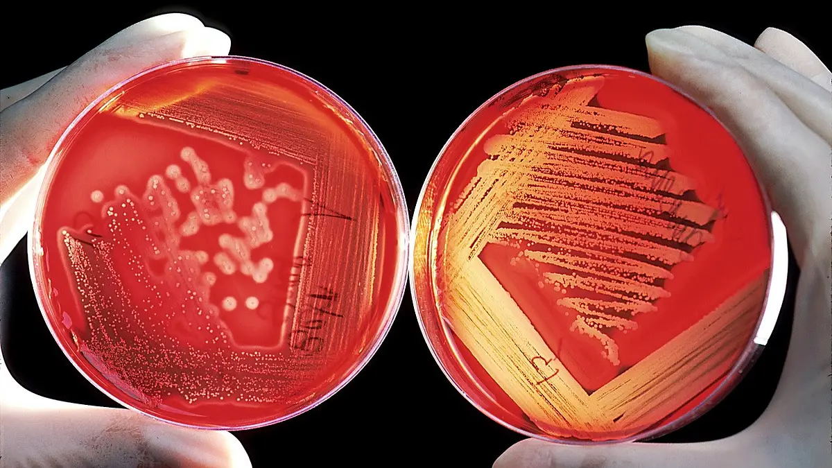Agar-agar: naturalna alternatywa dla żelatyny w kuchni