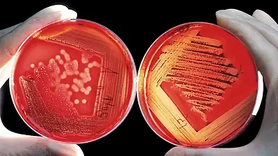 Agar-agar: naturalna alternatywa dla żelatyny w kuchni